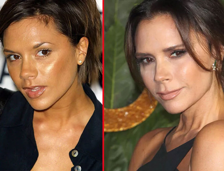 victoria beckham burun estetigi degil makyaj hilesi 4