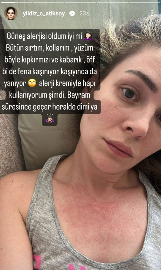 yildiz cagri atiksoy un son hali endiselendirdi 3